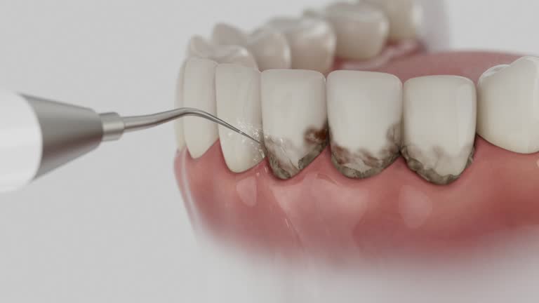 Reliable Dental Implants contractor in Ocean City, MD by Smile Center Dentistry